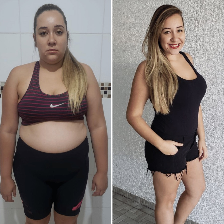 Antes e depois de paciente 2