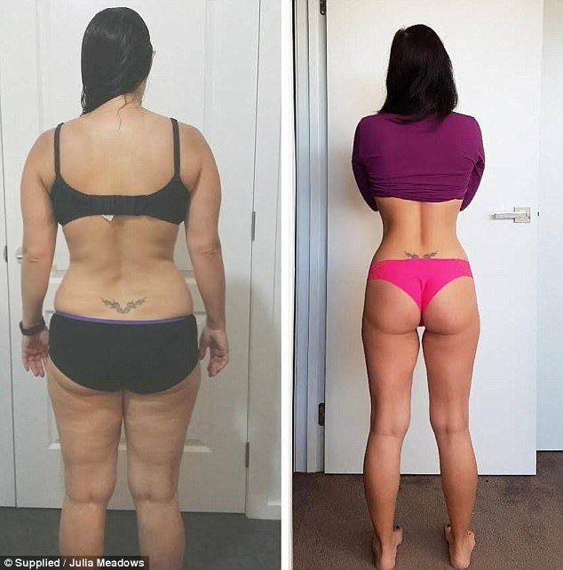Antes e depois de paciente 3