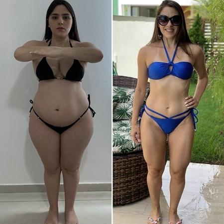 Antes e depois de paciente 4